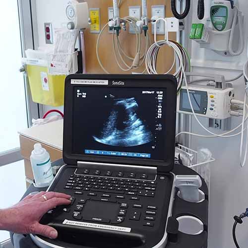 Ultrasound-Machines-for-the-ER